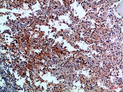 Fig.1. Immunohistochemical analysis of paraffin-embedded Human-spleen, antibody was diluted at 1:100.