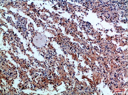 Fig.2. Immunohistochemical analysis of paraffin-embedded Human-spleen, antibody was diluted at 1:100.