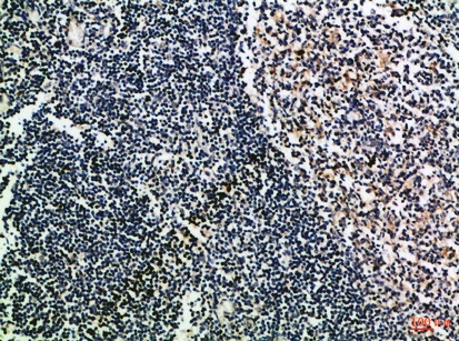 Fig.1. Immunohistochemical analysis of paraffin-embedded Human-tonsil, antibody was diluted at 1:100.
