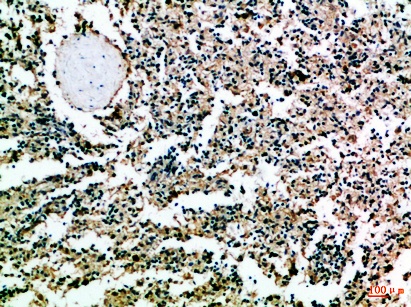 Fig.2. Immunohistochemical analysis of paraffin-embedded Human-spleen, antibody was diluted at 1:100.