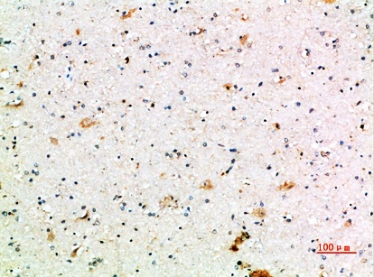 Fig.3. Immunohistochemical analysis of paraffin-embedded human-brain, antibody was diluted at 1:200.