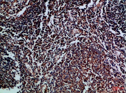 Fig.1. Immunohistochemical analysis of paraffin-embedded Human-tonsil, antibody was diluted at 1:100.
