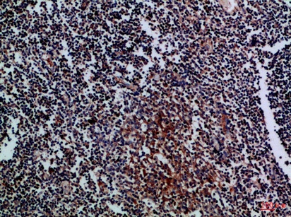 Fig.2. Immunohistochemical analysis of paraffin-embedded Human-tonsil, antibody was diluted at 1:100.