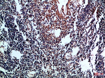 Fig.1. Immunohistochemical analysis of paraffin-embedded Human-tonsil, antibody was diluted at 1:100.