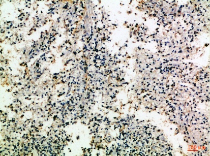 Fig.2. Immunohistochemical analysis of paraffin-embedded Human-spleen, antibody was diluted at 1:100.