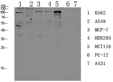 Fig.1. Western blot analysis of various lysate, antibody was diluted at 1:1000. HRP, Goat Anti-Rabbit IgG (Cat #: A21020) secondary antibody was diluted at 1:20000.