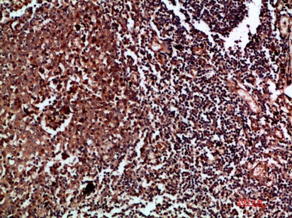 Fig.2. Immunohistochemical analysis of paraffin-embedded human-tonsil, antibody was diluted at 1:200.