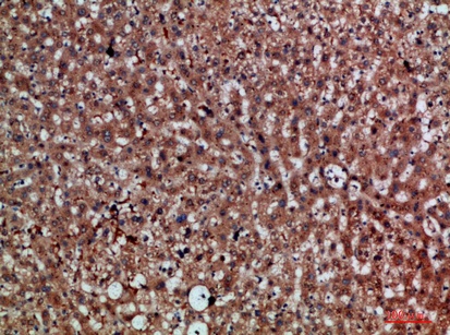 Fig.1. Immunohistochemical analysis of paraffin-embedded human-liver, antibody was diluted at 1:200.
