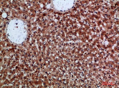 Fig.2. Immunohistochemical analysis of paraffin-embedded human-liver, antibody was diluted at 1:200.
