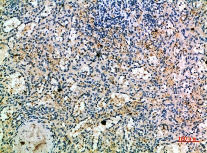Fig.2. Immunohistochemical analysis of paraffin-embedded human-spleen, antibody was diluted at 1:200.