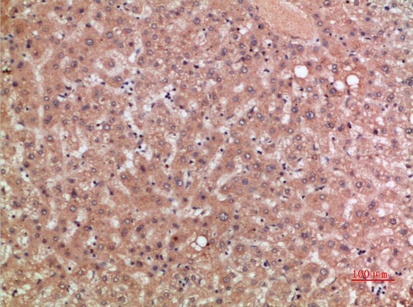 Fig.2. Immunohistochemical analysis of paraffin-embedded human-liver, antibody was diluted at 1:200.