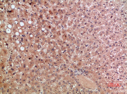 Fig.3. Immunohistochemical analysis of paraffin-embedded human-liver, antibody was diluted at 1:200.