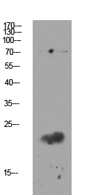 Fig.1. Western blot analysis of Mouse-kidney lysate, antibody was diluted at 1:1000. HRP, Goat Anti-Rabbit IgG (Cat #: A21020) secondary antibody was diluted at 1:20000.