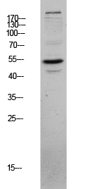 Fig.1. Western blot analysis of MCF-7 lysate, antibody was diluted at 1:1000. HRP, Goat Anti-Rabbit IgG (Cat #: A21020) secondary antibody was diluted at 1:20000.