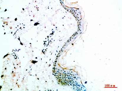 Fig.1. Immunohistochemical analysis of paraffin-embedded human-skin, antibody was diluted at 1:200.