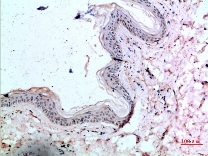 Fig.1. Immunohistochemical analysis of paraffin-embedded human-skin, antibody was diluted at 1:200.