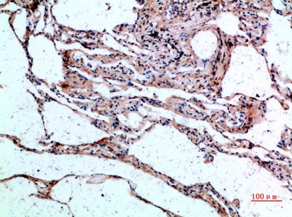 Fig.2. Immunohistochemical analysis of paraffin-embedded human-lung, antibody was diluted at 1:200.