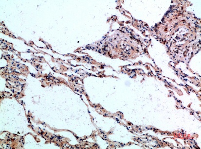 Fig.3. Immunohistochemical analysis of paraffin-embedded human-lung, antibody was diluted at 1:200.