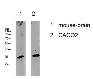 Fig.1. Western blot analysis of various lysate, antibody was diluted at 1:1000. HRP, Goat Anti-Rabbit IgG (Cat #: A21020) secondary antibody was diluted at 1:20000.