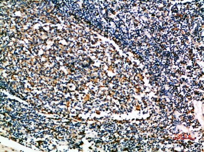 Fig.2. Immunohistochemical analysis of paraffin-embedded human-tonsil, antibody was diluted at 1:200.