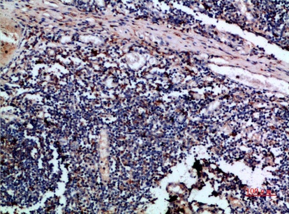 Fig.3. Immunohistochemical analysis of paraffin-embedded human-tonsil, antibody was diluted at 1:200.