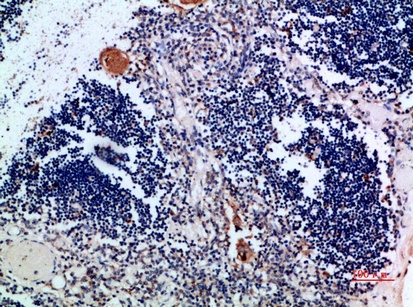Fig.4. Immunohistochemical analysis of paraffin-embedded human-thymus, antibody was diluted at 1:200.