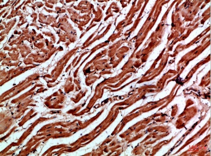 Fig.1. Immunohistochemical analysis of paraffin-embedded Human-heart, antibody was diluted at 1:100.