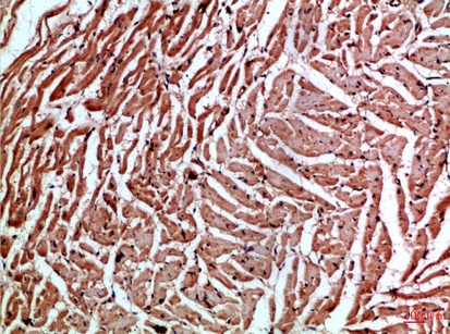 Fig.2. Immunohistochemical analysis of paraffin-embedded Human-heart, antibody was diluted at 1:100.