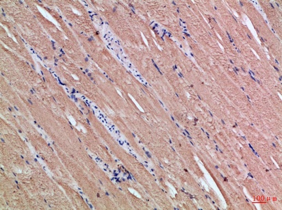 Fig.3. Immunohistochemical analysis of paraffin-embedded Human-skeletal-muscle, antibody was diluted at 1:100.