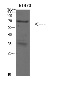Fig.1. Western blot analysis of SKOV3 293T lysate, antibody was diluted at 1:500. HRP, Goat Anti-Rabbit IgG (Cat #: A21020) secondary antibody was diluted at 1:20000.