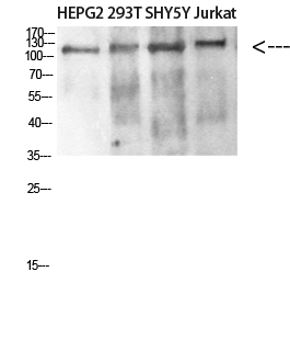 Fig.1. Western blot analysis of SW480 MCF7 lysate, antibody was diluted at 1:500. HRP, Goat Anti-Rabbit IgG (Cat #: A21020) secondary antibody was diluted at 1:20000.