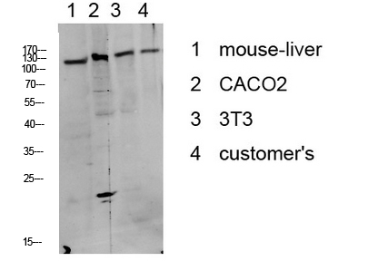 Fig.1. Western blot analysis of various lysate, antibody was diluted at 1:1000. HRP, Goat Anti-Rabbit IgG (Cat #: A21020) secondary antibody was diluted at 1:20000.