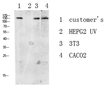Fig.1. Western blot analysis of various lysate, antibody was diluted at 1:1000. HRP, Goat Anti-Rabbit IgG (Cat #: A21020) secondary antibody was diluted at 1:20000.