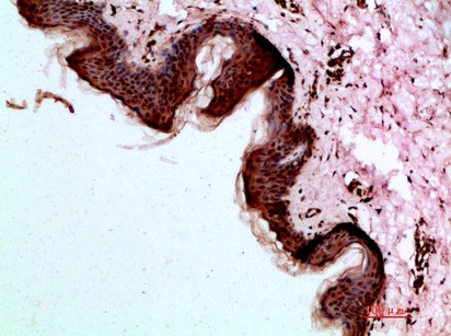 Fig.3. Immunohistochemical analysis of paraffin-embedded human-skin, antibody was diluted at 1:200.