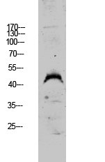Fig.1. Western blot analysis of A549 lysate, antibody was diluted at 1:1000. HRP, Goat Anti-Rabbit IgG (Cat #: A21020) secondary antibody was diluted at 1:20000.
