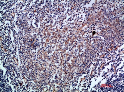 Fig.2. Immunohistochemical analysis of paraffin-embedded human-tonsil, antibody was diluted at 1:200.