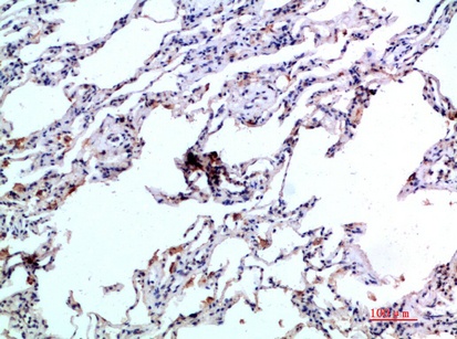 Fig.1. Immunohistochemical analysis of paraffin-embedded human-lung, antibody was diluted at 1:200.