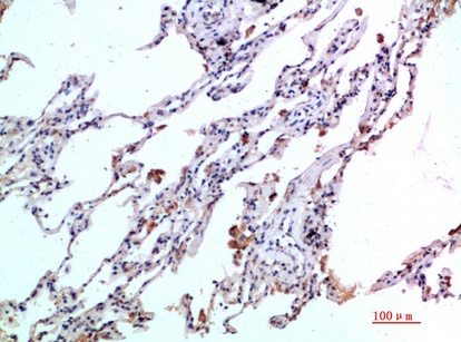 Fig.2. Immunohistochemical analysis of paraffin-embedded human-lung, antibody was diluted at 1:200.