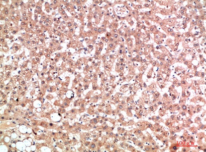 Fig.1. Immunohistochemical analysis of paraffin-embedded human-liver, antibody was diluted at 1:200.