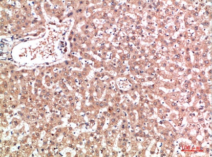 Fig.2. Immunohistochemical analysis of paraffin-embedded human-liver, antibody was diluted at 1:200.