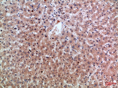 Fig.1. Immunohistochemical analysis of paraffin-embedded Human-liver, antibody was diluted at 1:100.