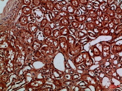 Fig.1. Immunohistochemical analysis of paraffin-embedded Human-kidney, antibody was diluted at 1:100.