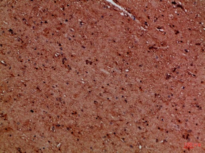 Fig.3. Immunohistochemical analysis of paraffin-embedded Human-brain, antibody was diluted at 1:100.