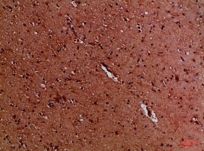 Fig.4. Immunohistochemical analysis of paraffin-embedded Human-brain, antibody was diluted at 1:100.