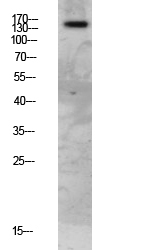 Fig.1. Western blot analysis of Mouse-lung lysate, antibody was diluted at 1:1000. HRP, Goat Anti-Rabbit IgG (Cat #: A21020) secondary antibody was diluted at 1:20000.