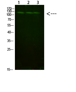 Fig.1. Western Blot analysis of 1, Mouse-liver 2, hela 3,Mouse-brain cells using primary antibody diluted at 1:1000 (4°C overnight). Goat Anti-rabbit IgG Dylight 800 (Cat #: A23920) secondary antibody was diluted at 1:5000 at 25°C for 1 hour.