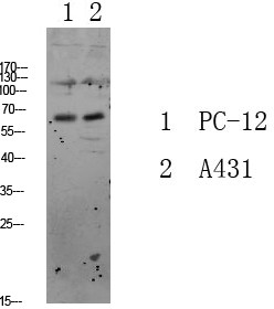 Fig.1. Western blot analysis of various lysate, antibody was diluted at 1:1000. HRP, Goat Anti-Rabbit IgG (Cat #: A21020) secondary antibody was diluted at 1:20000.