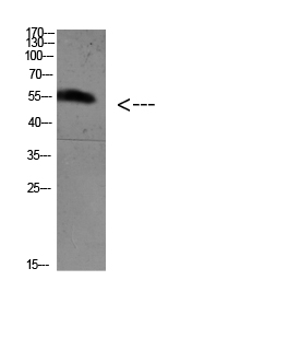 Fig.1. Western blot analysis of 3T3 Mouse-kidney KB K562 Hela lysate, antibody was diluted at 1:500. HRP, Goat Anti-Rabbit IgG (Cat #: A21020) secondary antibody was diluted at 1:20000.