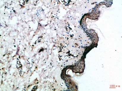 Fig.1. Immunohistochemical analysis of paraffin-embedded Human-skin, antibody was diluted at 1:100.