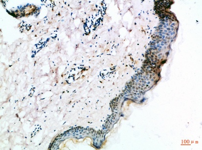 Fig.2. Immunohistochemical analysis of paraffin-embedded Human-skin, antibody was diluted at 1:100.